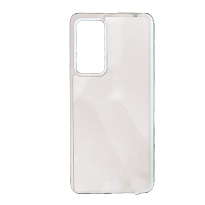 Coque sublimation 2D TPU pour Xiaomi Mi 14 Ultra, 14 Pro, 13T, 13, 12 5G, 11, 10, 10 lite, 9, 8, A2. La plaque arrière en aluminium dédiée à la sublimation permet la personnalisation de la coque